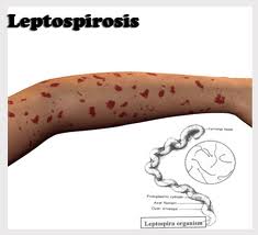 Obat Herbal Leptospirosis